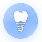 Single Dental Implant