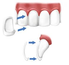 Cosmetic Dentistry