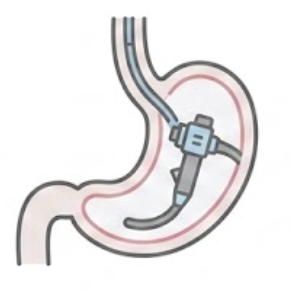 Painless Gastroscopy